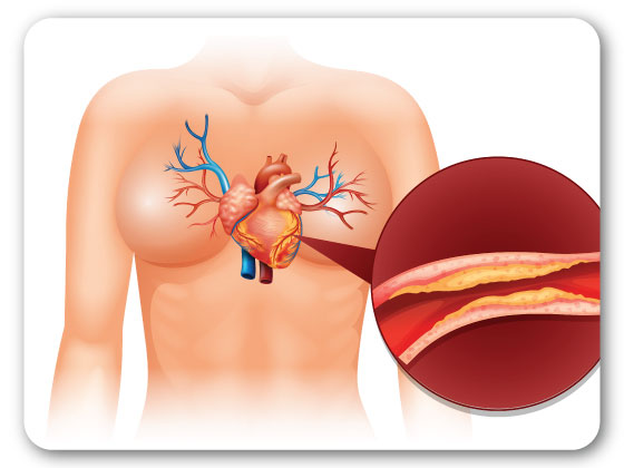 Dr Pranoy best-ivc-filters-treatment-in-Habsiguda
